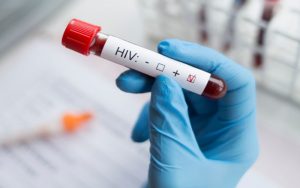 Nova variante do HIV é detectada na Bahia, no Rio de Janeiro e no Rio Grande do Sul