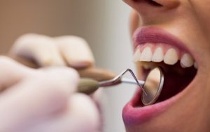 Ministério da Saúde garante o maior recurso da história para saúde bucal