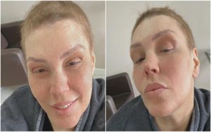 Simony mostra crescimento do cabelo, após fim de tratamento contra o câncer